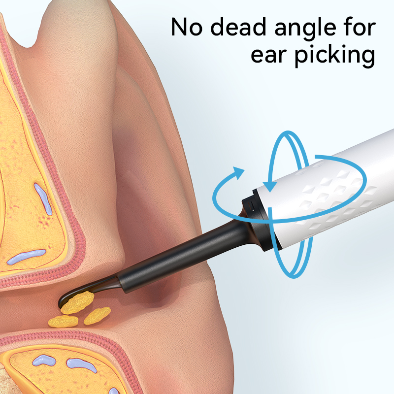 Ear cleaner for video cameras, - Health Power Tools 评论和价格